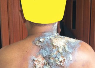 Pekerja Gudang di Wilayah Hukum Polsek Cileungsi Mengaku Dikeroyok Usai Dituduh Mencuri Helm